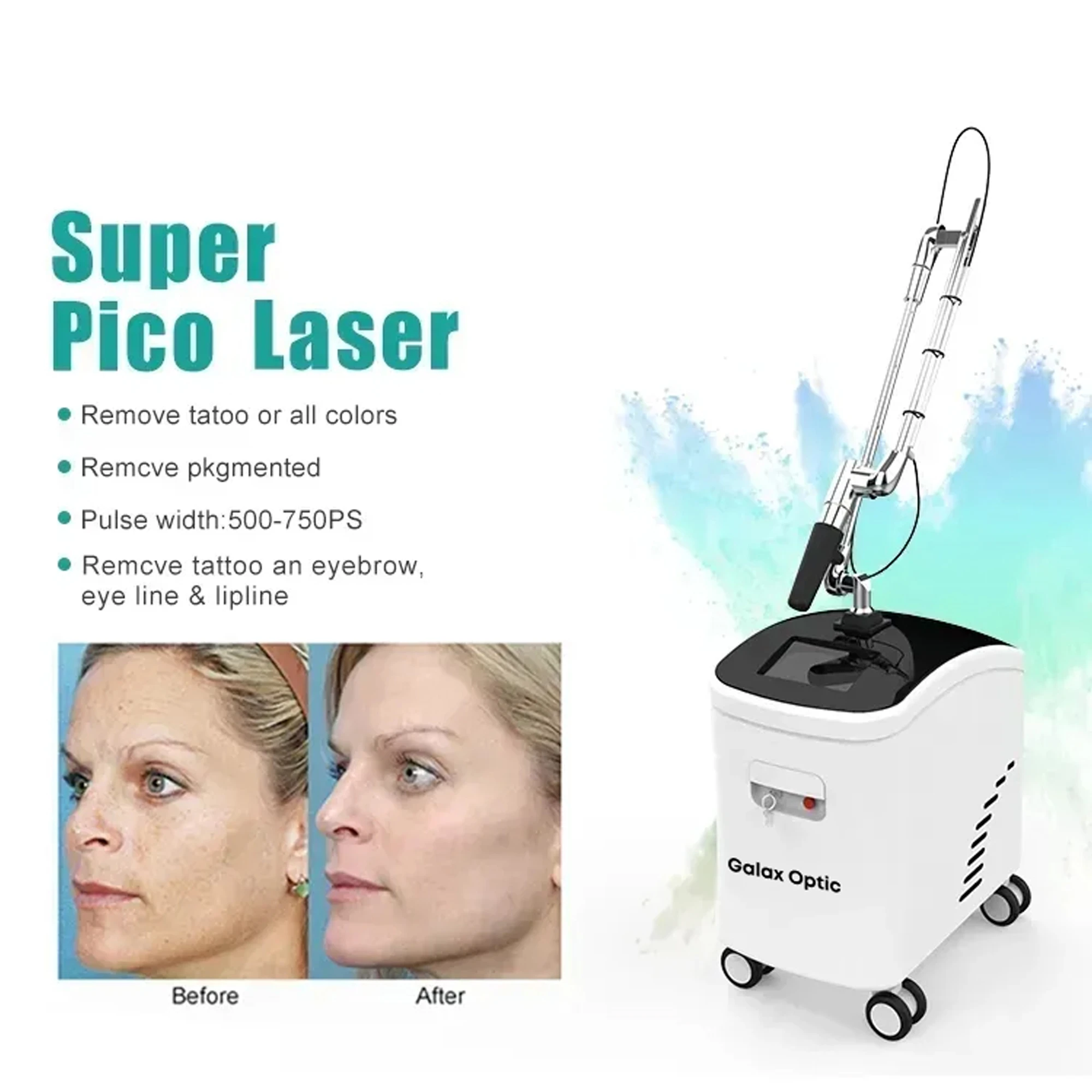 8bfca4212a62f3012fbfccd8d407caa1 Is picosecond laser hair removal permanent?