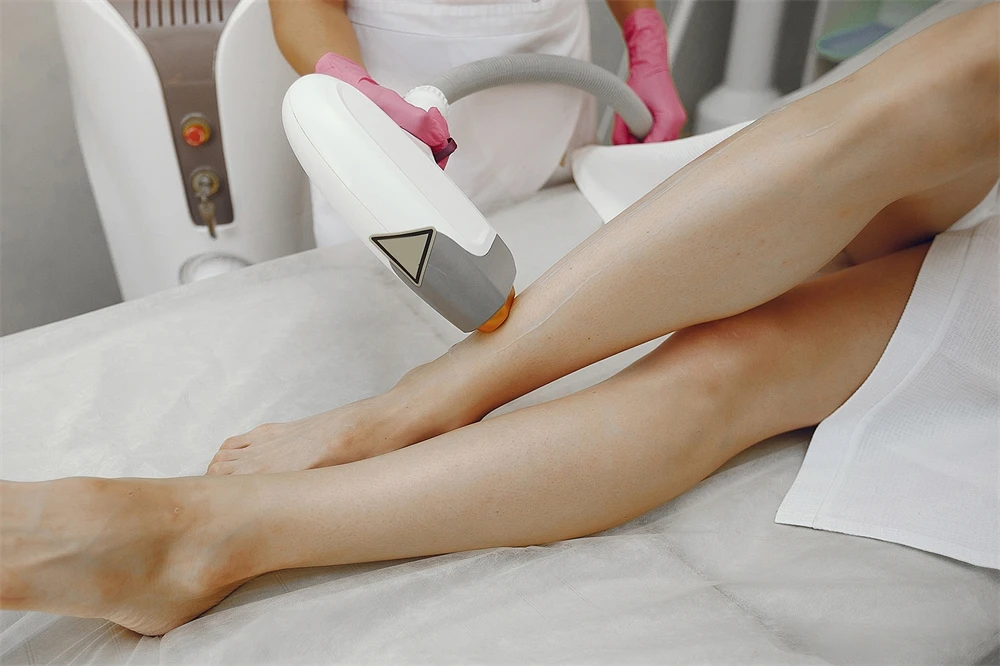 Laser beauty leg rejuvenation